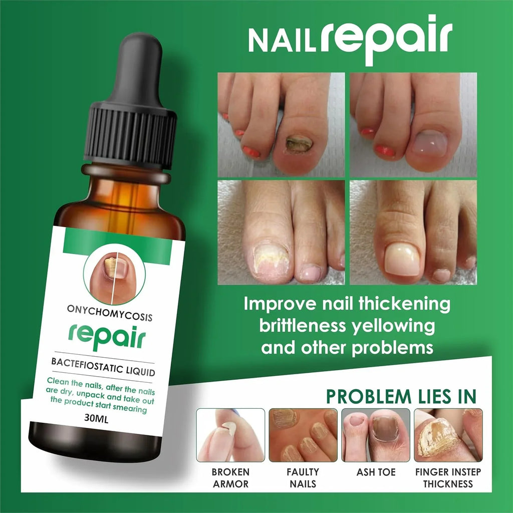 Nail Repair Serum (📢Buy 1 Get 1 FREE) MAN & WOMAN