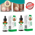 Nail Repair Serum (📢Buy 1 Get 1 FREE) MAN & WOMAN